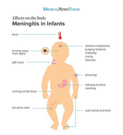 Meningitis in babies: Symptoms and treatment