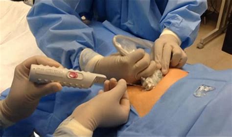 Liver Biopsy Procedure, Indications, Risks and Complications - Jotscroll