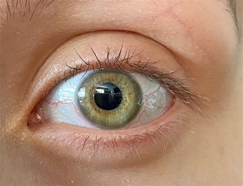 Anyone know what the ring around the pupil is called? : r/eyes