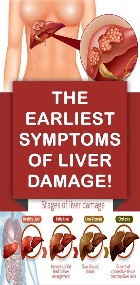 The Earliest Symptoms Of Liver Damage! - crishealth