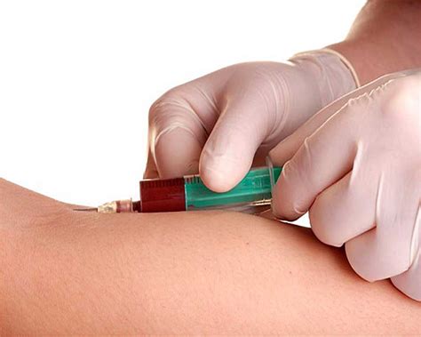 AST SGOT Levels: Understanding the Result - Fatty Liver Disease