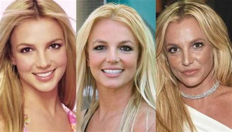 Britney Spears Plastic Surgery Before and After Pictures 2022