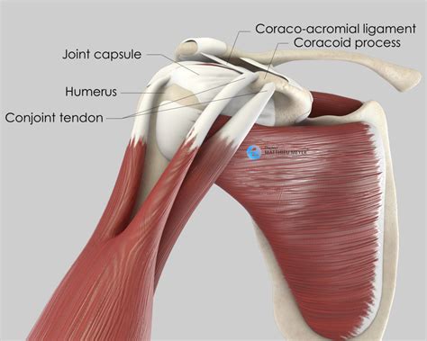 STABLE: a shoulder instability research trial - BSM Foundation