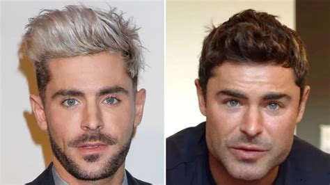 Zac Efron Transformation: Actor Revealed What Really Happened to His ...