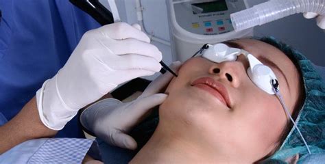 Carbon Dioxide Laser for Syringoma | Cosmetics M.D.