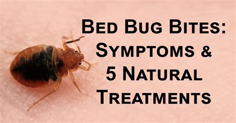 Bed Bug Bites Treatment