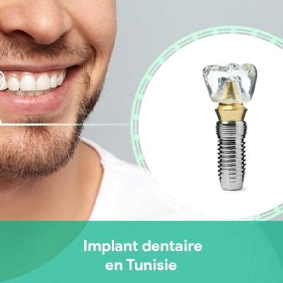 Implant dentaire Tunisie à bas prix - Implantologie dentaire