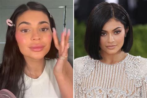 Kylie Jenner's fans beg star to stop with lip fillers as throwback photos show her 'real ...