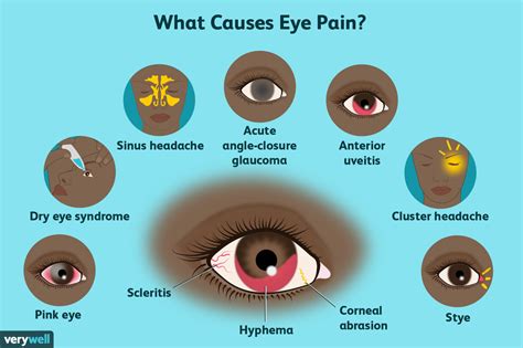 Eye Pain: Causes, Treatment, and When to See a Healthcare Provider