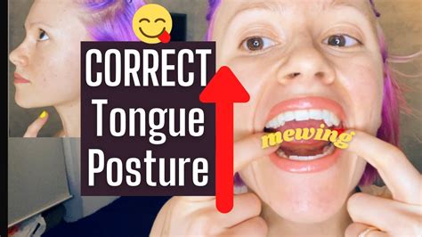 Mewing - How to Achieve Correct Tongue Posture: Placement, Back 1/3 ...