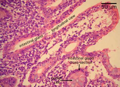 Appendix Histology - Appendix (labels) - histology slide