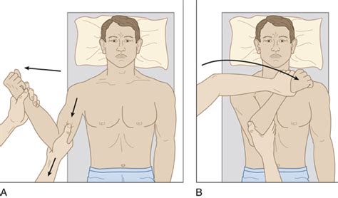 Shoulder Dislocation | Anesthesia Key