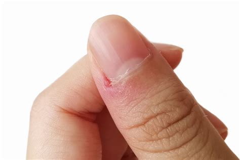 What's Up With That: Your Fingernails Grow Way Faster Than Your, grow nails