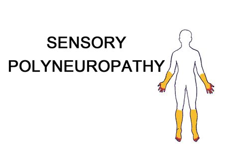 Nortriptyline most effective drug for sensory polyneuropathy, reveals ...