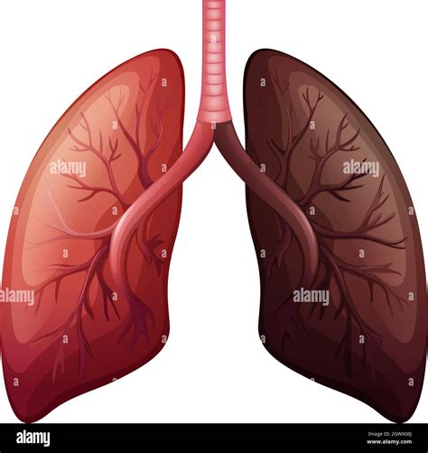 Lung cancer diagram in large scale Stock Vector Image & Art - Alamy