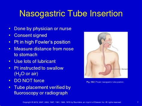 Figure 18-3 from Nasogastric tube insertion. | Semantic Scholar