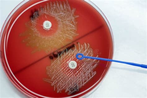 Streptococcus Pneumoniae Blood Agar