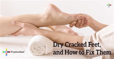 Dry Cracked Feet, and How to Fix Them