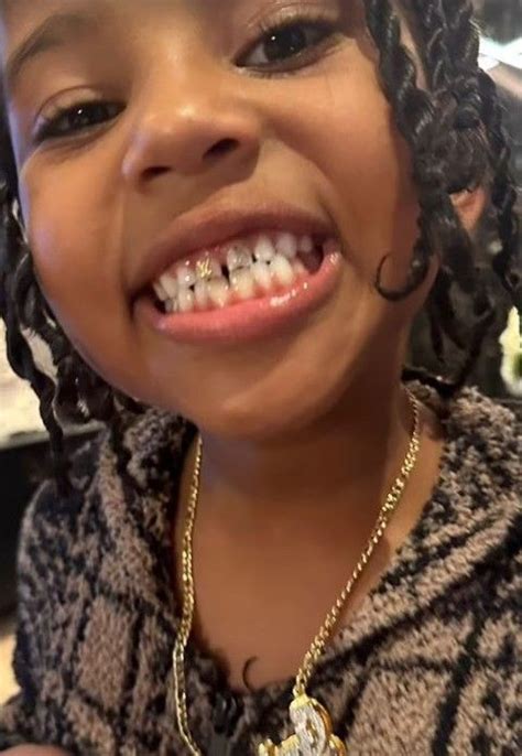 Kim Kardashian's daughter North West unveils dramatic teeth ...