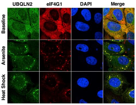 Liquid-Liquid Phase Separation in Protein Quality Control – Castañeda Lab