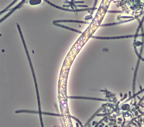 Beggiatoa filament morphotypes - Ryan Hennessy Wastewater Microbiology