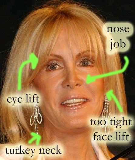 Celebrity Plastic Surgery Before and After: Joan Van Ark Plastic Surgery Before and After Nose ...