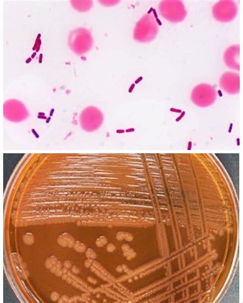 Proteus mirabilis #microbiology #microbiologia #bacteriologia #bacteria #culture #microscope # ...