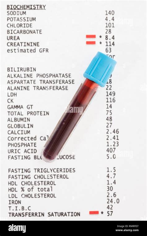 Blood Test Results High Resolution Stock Photography and Images - Alamy