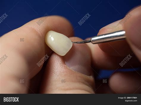 Dental Technician Image & Photo (Free Trial) | Bigstock