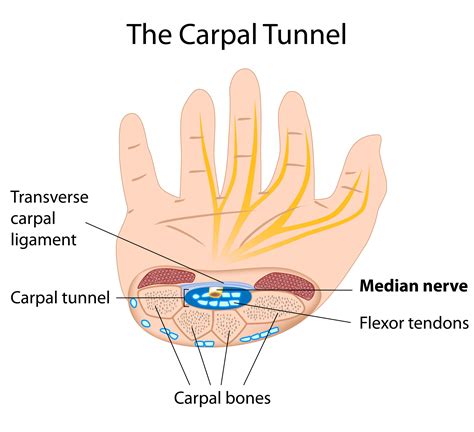 Carpal Tunnel Syndrome | Physiotherapy Treatment Singapore. Fast pain relief. Time for a fuller ...