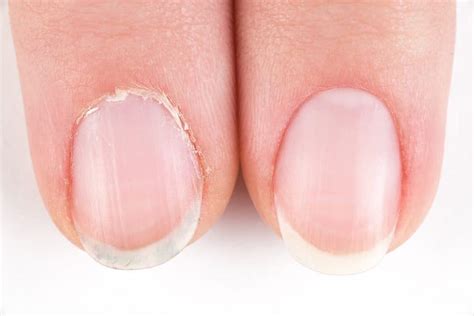 What Are Cuticles? + Cuticle Care 101