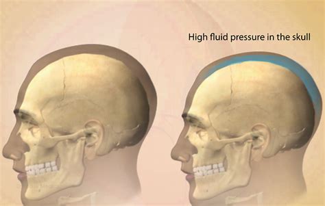 Health Condition : Symptoms, Causes, Treatment and More