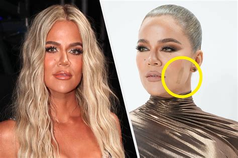 Khloé Kardashian Explained Why She's Still Wearing A Band-Aid Months ...