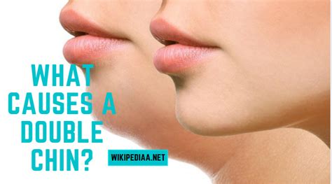 Do You Know? What Causes a Double Chin | Secret Reveal