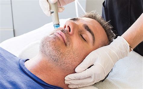 Skin Care Hydrafacial - Top 10 Makeovers for Men from Best Self Atlanta