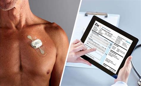 Heart Holter Monitoring to Diagnose Palpitations - Get Help