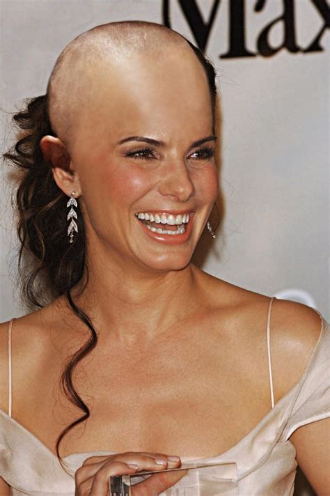 Funny Bald Hollywood Celebrities | Funny Collection World