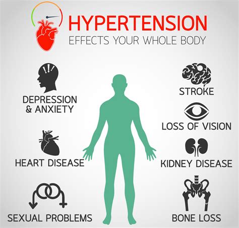 Idiopathic Hypertensia: Exploring the Link to Obesity - Colonic at ...