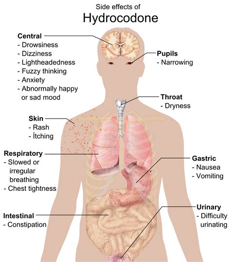 File:Side effects of Hydrocodone.png - Wikipedia