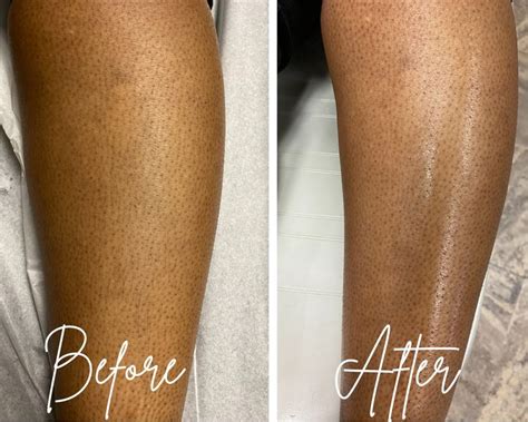 Leg Waxing in 2021 | Beauty school, Facial skin care, Salon professional