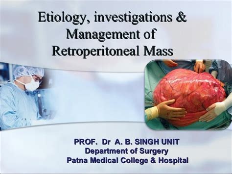 Retroperitoneal mass