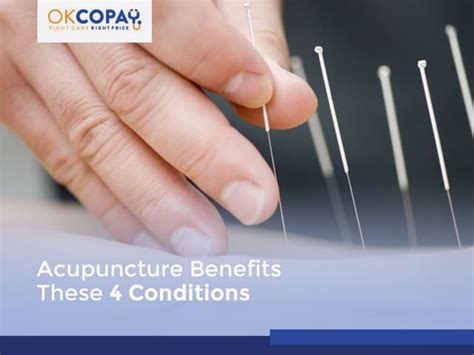 Acupuncture Benefits These 4 Conditions