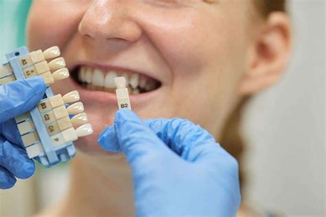 What Is the Treatment for Stained Teeth? - Devonshire Dental Care