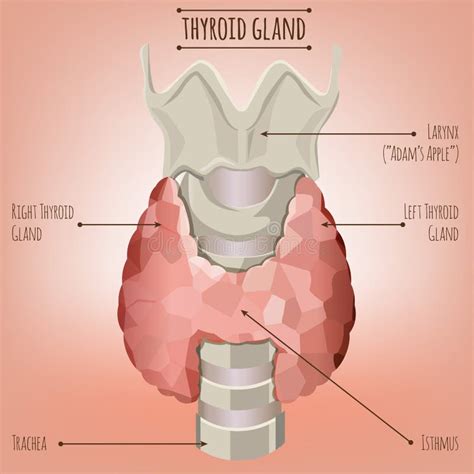 Hipertiroidismo Y Tráquea Mostrados En Una Mujer Concepto MÉDICO Anatomía De La Gente ...