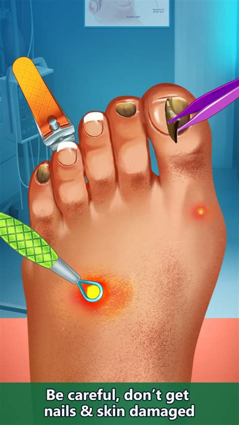 Aggregate 145+ toe nail doctor games super hot - ceg.edu.vn