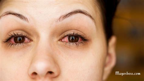 Eye Infection Symptoms, Types, and Treatment