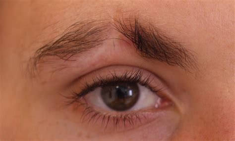 Medical tattooing for Scar in Eyebrow (male) - Rae Denman