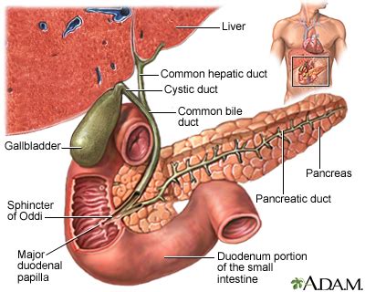 Gallstones Symptoms, Doctors, Treatments, Advances & More | MediFind