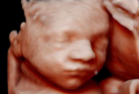 3d early gender ultrasound near me - Danette Robles