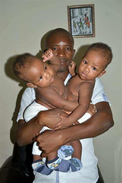 Nigerian conjoined Twins finally gets separated after successful surgery involving 22 doctors ...